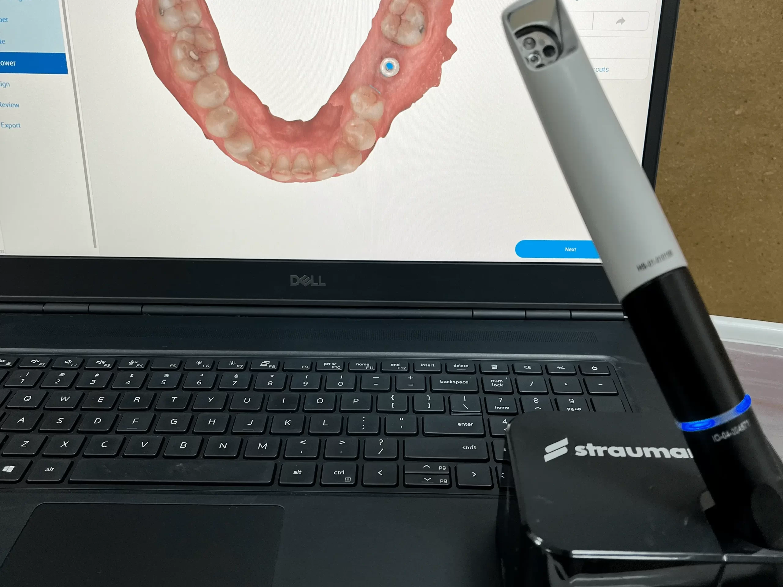 Facekraft Dental Implants Clinic photo 1