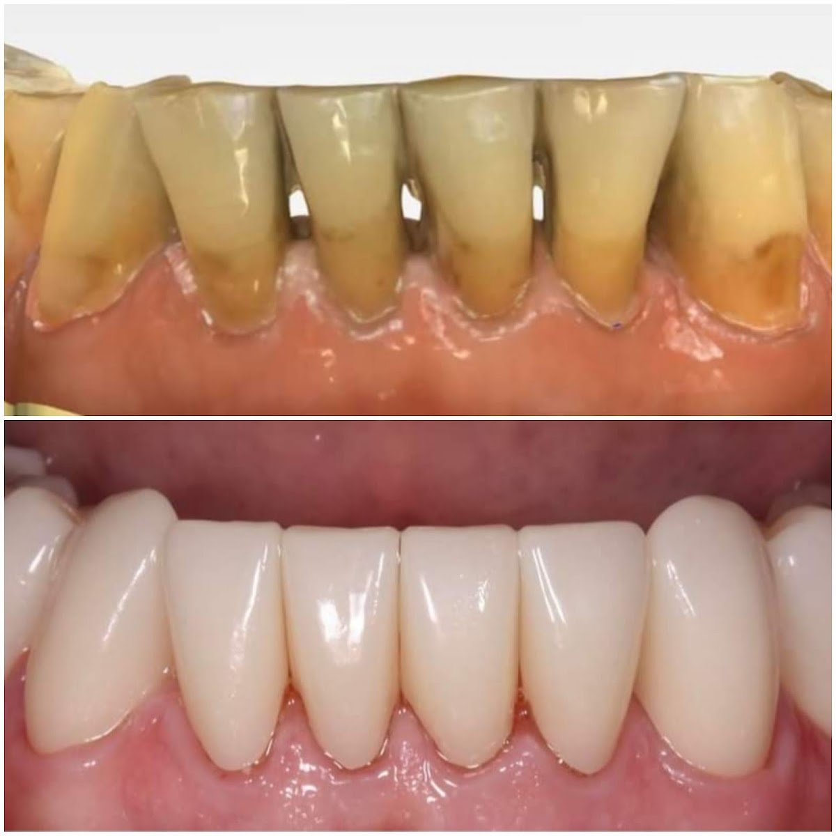 Smiline Dental photo 5