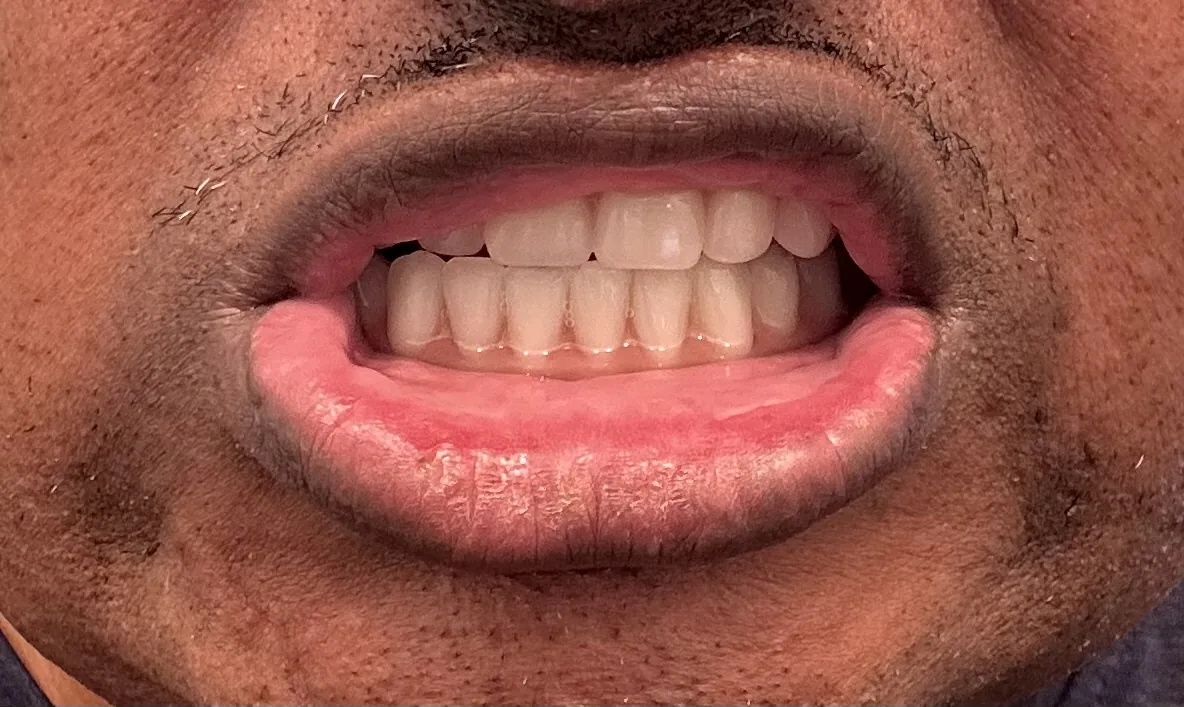 Envision Dental Implant Center - Charlotte photo 6