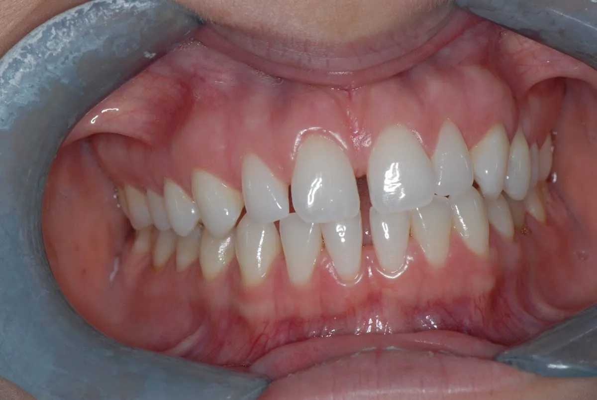 Lakeview Dental Care photo 4