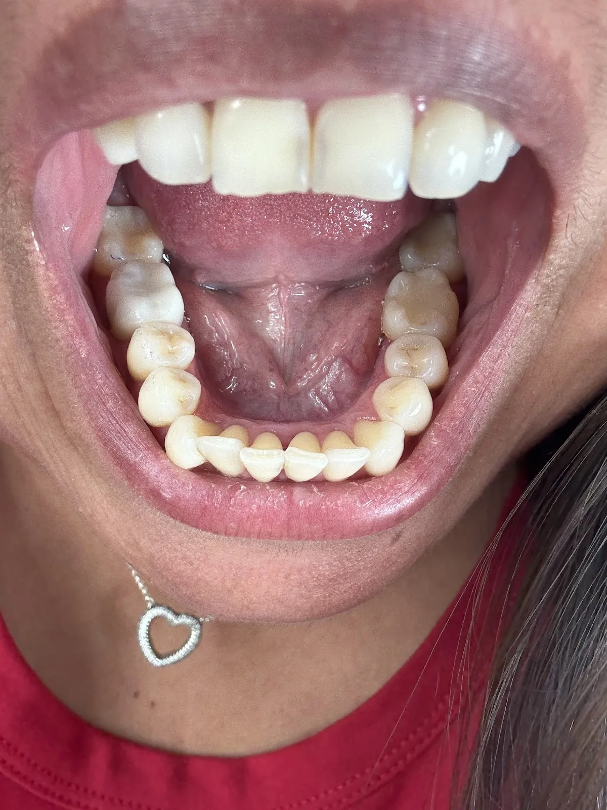 Exceptional Dentistry of Chandler photo 6