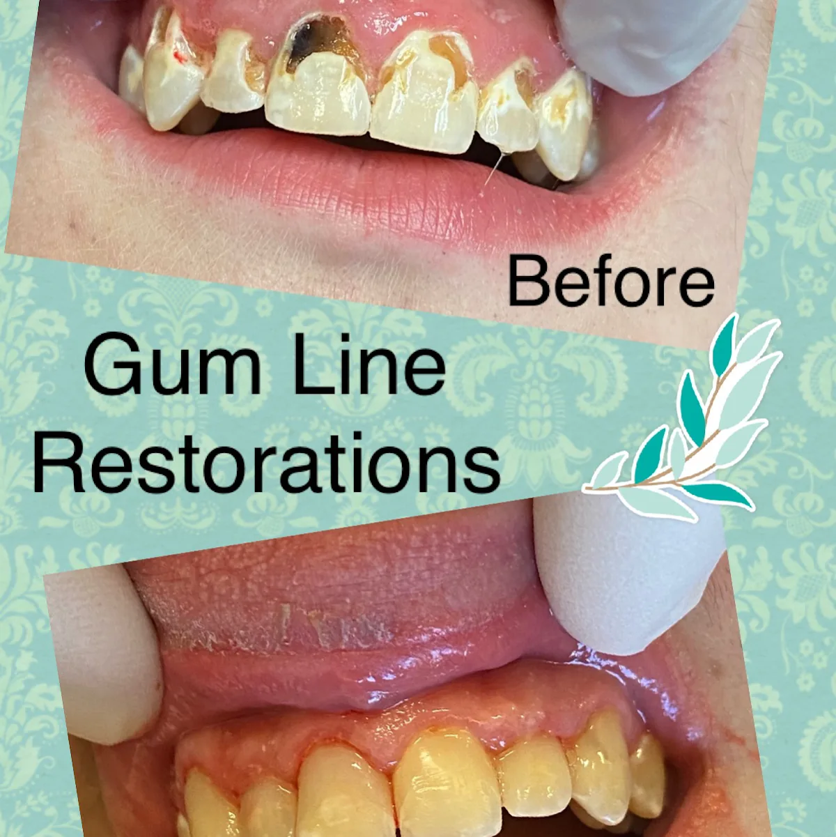 Lakeland Hills Dental: Walter J Jankowski DMD photo 3