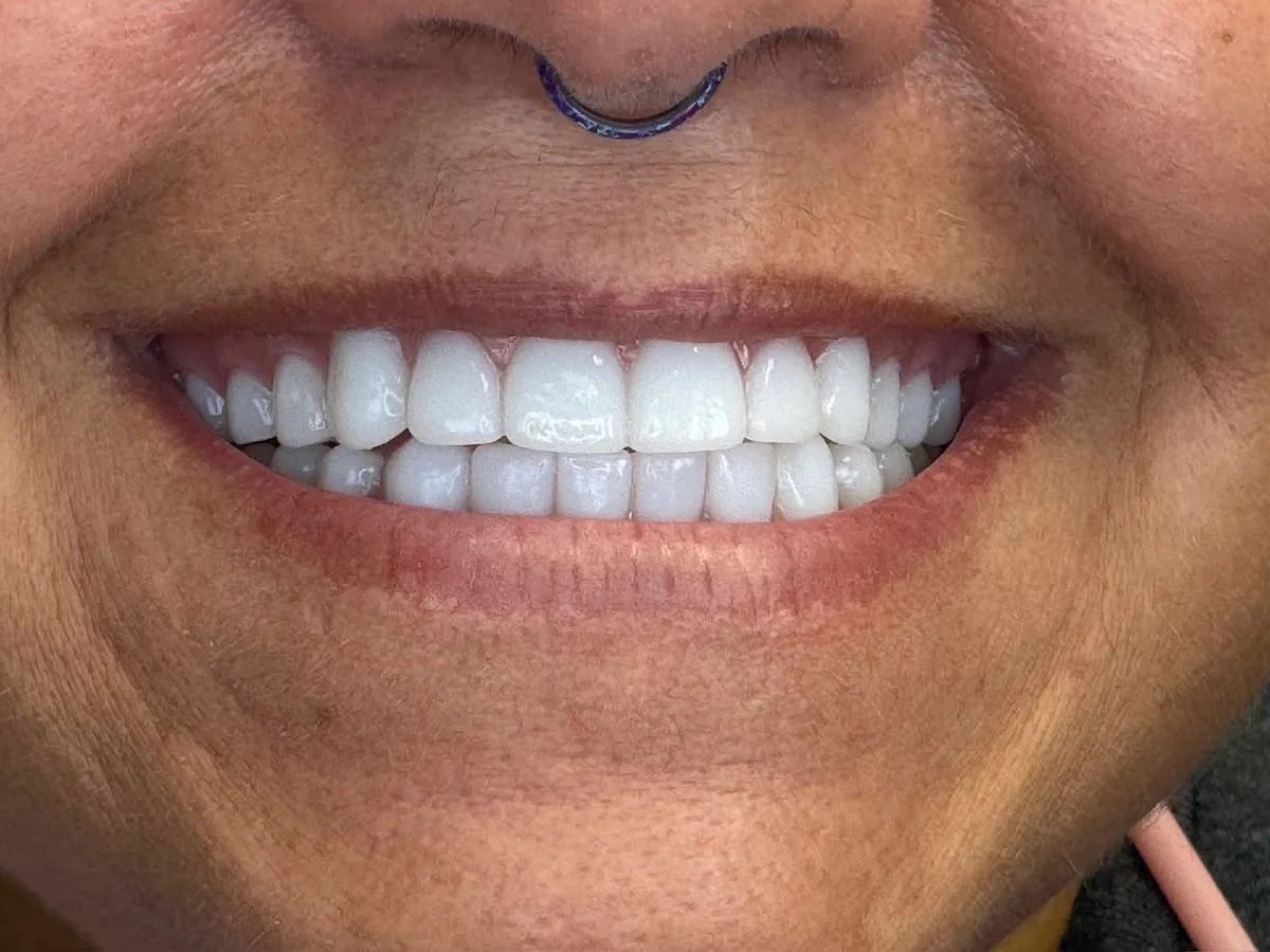 Charlotte Dental Arts photo 3