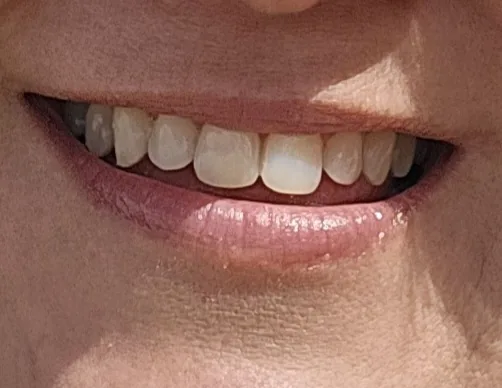 Comfort Dental - Brentwood Hills photo 5