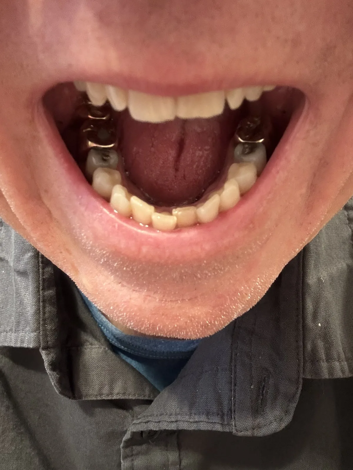 Comfort Dental - Brentwood Hills photo 4