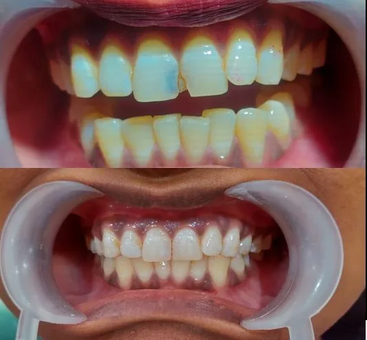 First Care Dental Associates photo 8