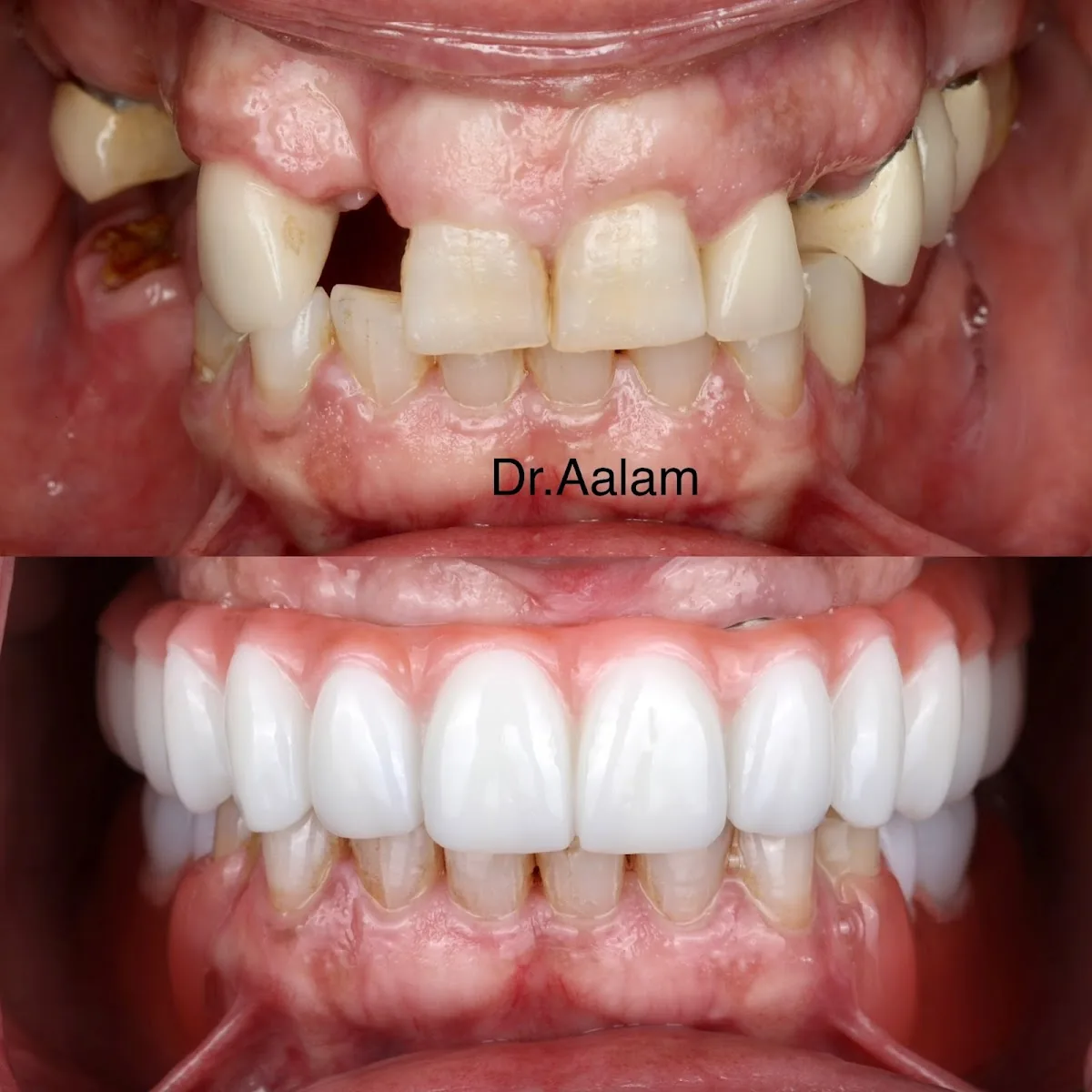 CENTER for Advanced Periodontal & Implant Therapy photo 1