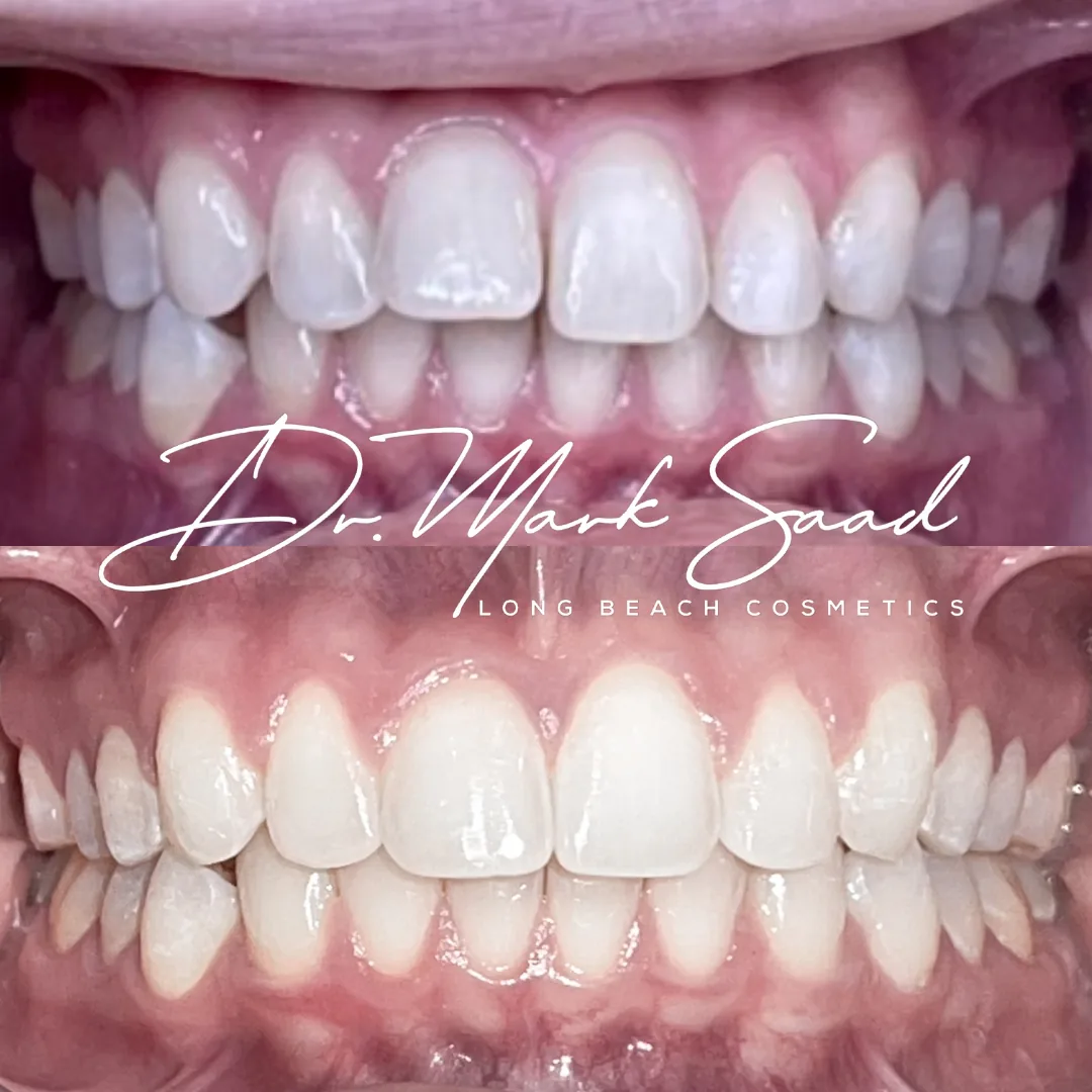 Long Beach Dental Health photo 2