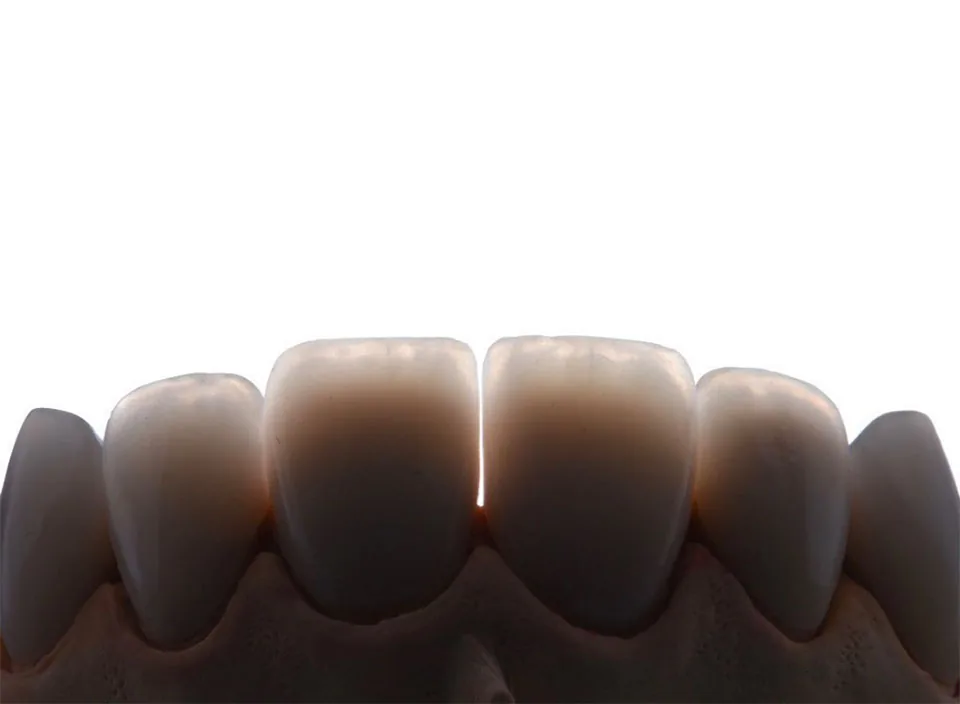 Fuller Smiles - Dentist - Long Beach photo 4