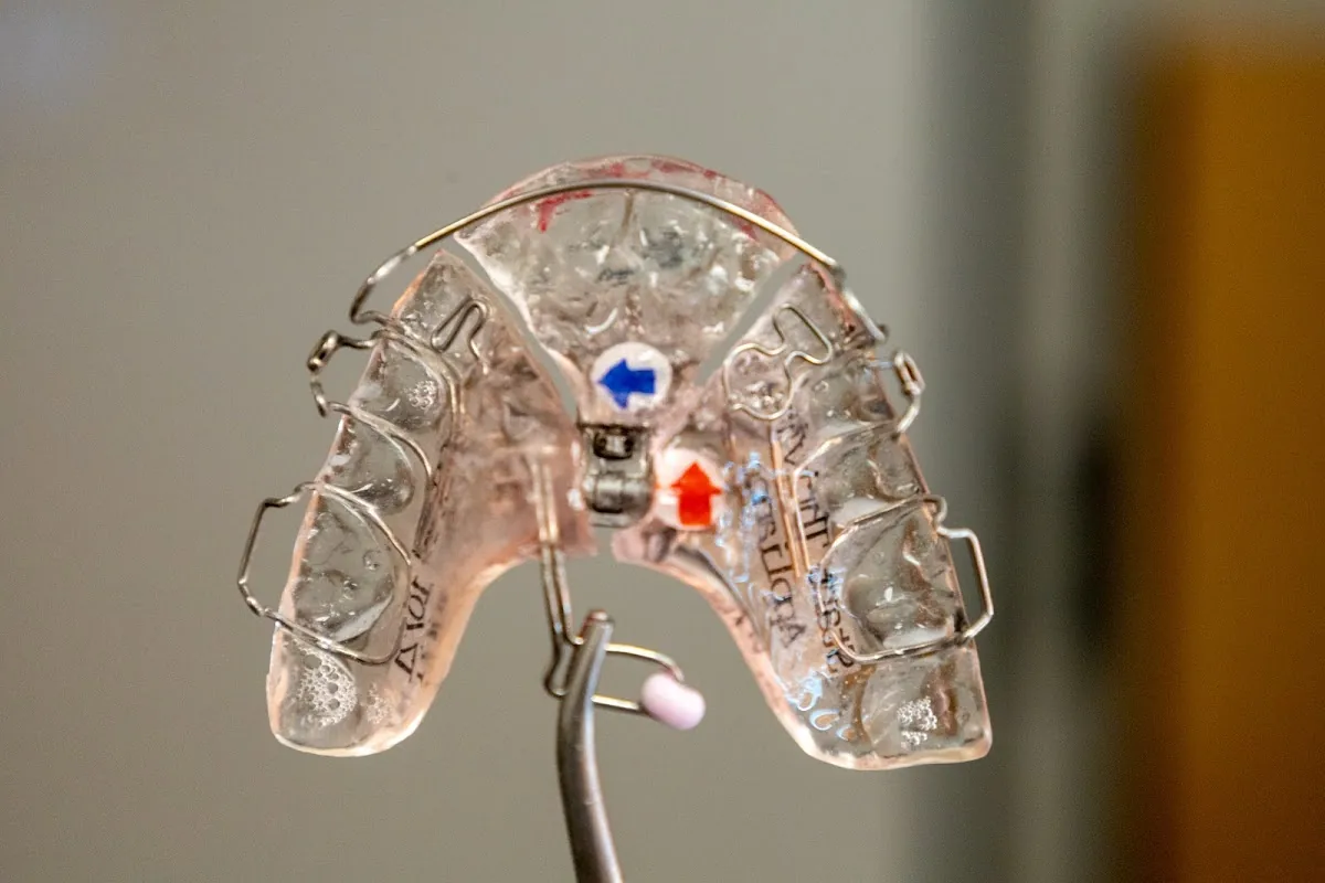 Holistic TMJ And Sleep Center Brights Smile Design photo 5