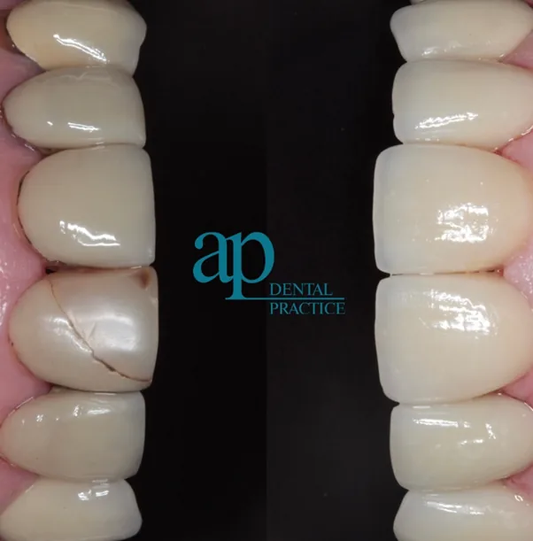 Allesleyparkdental.co.uk photo 4