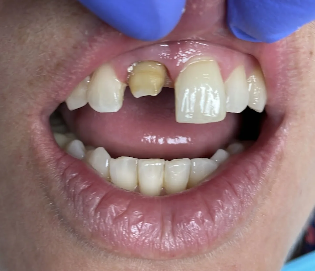 Aesthetic Dental Greenpoint Brooklyn photo 4