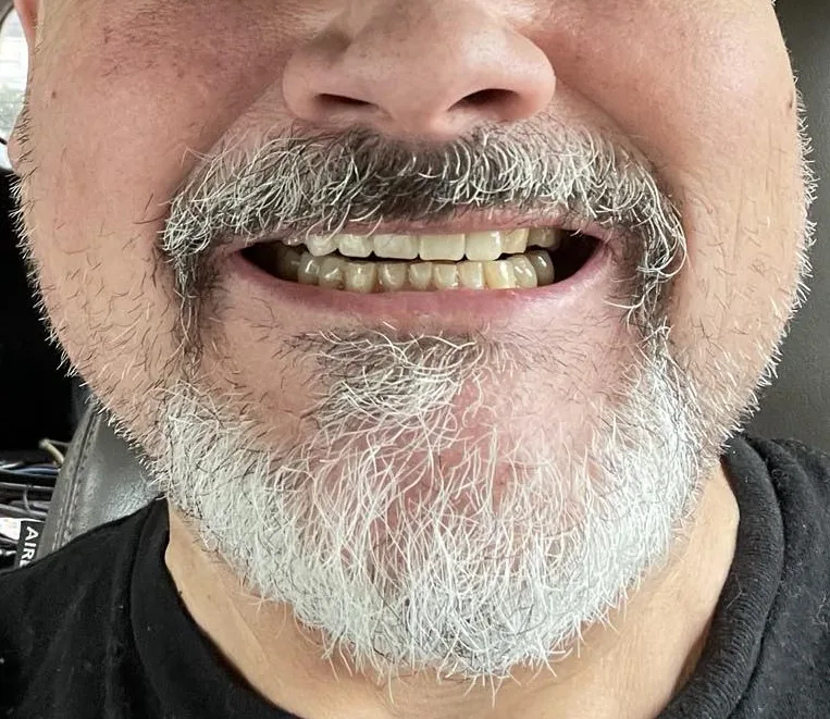 Affordable Dentures & Implants photo 3