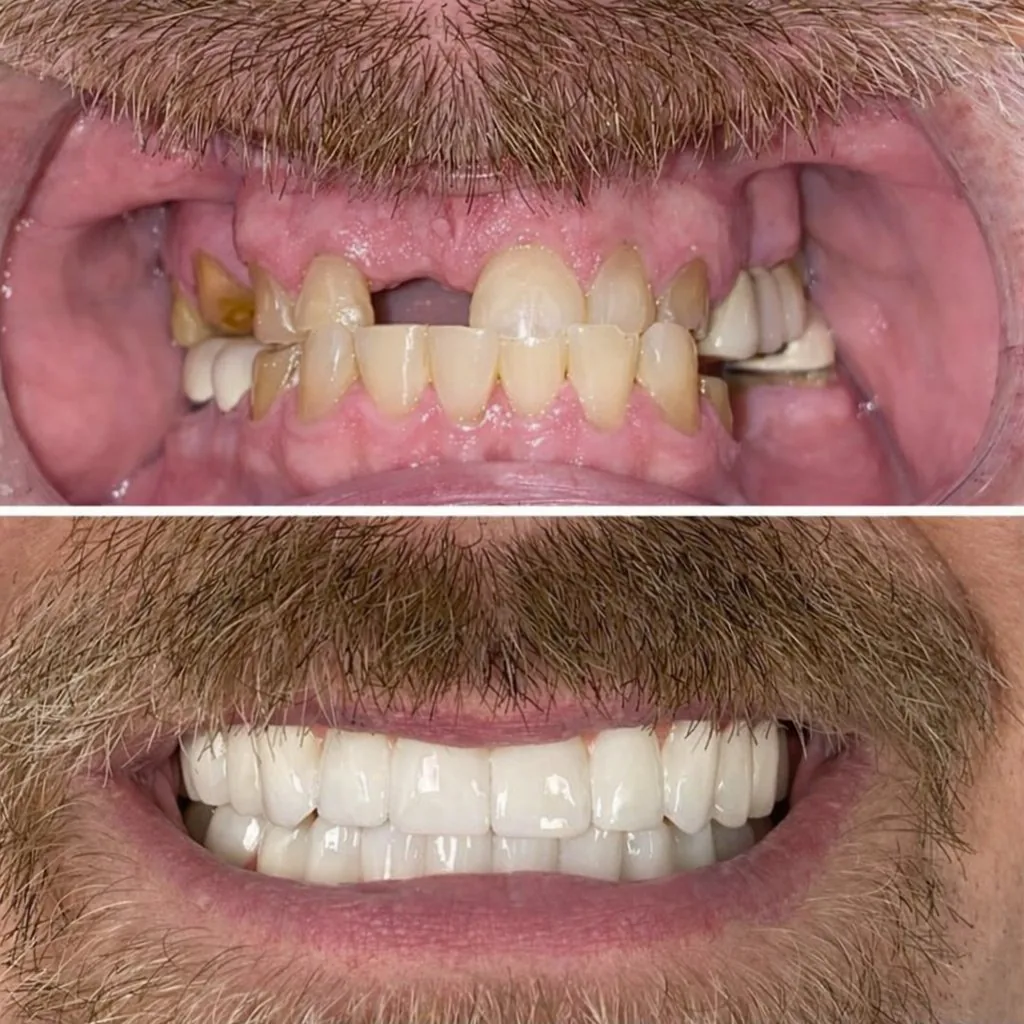 Nashville Dentures & Implants photo 4