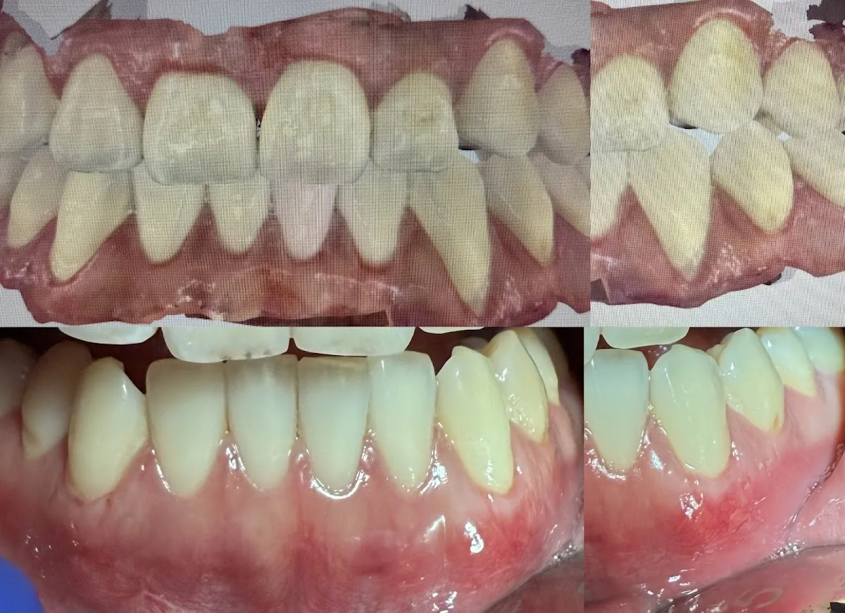 Bay Area Dental & Implant Center photo 2