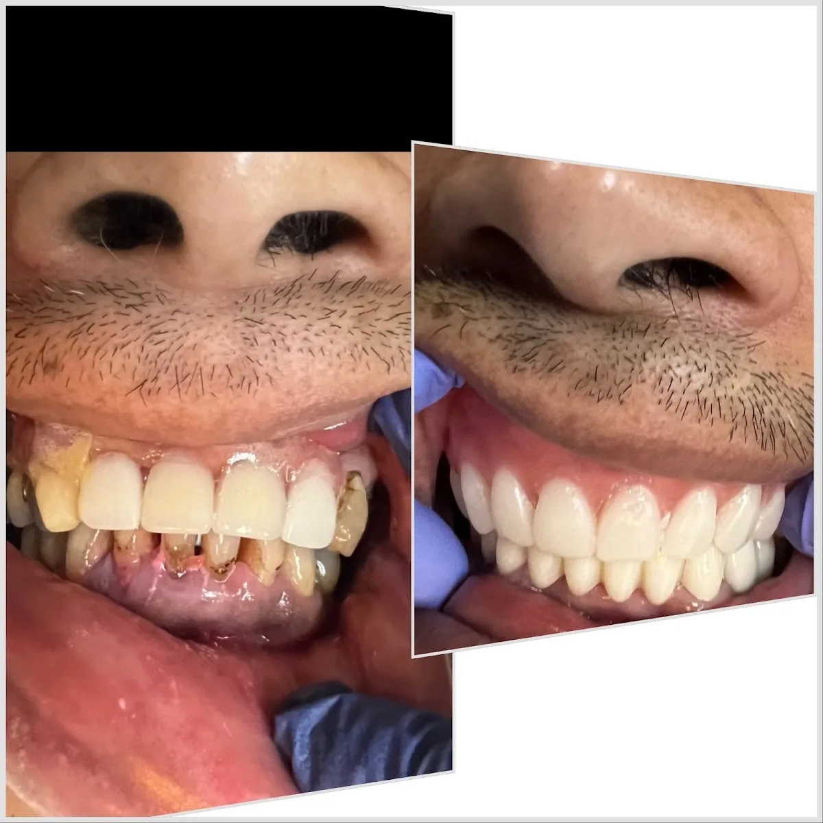 Laser Regen & Implant Center photo 1