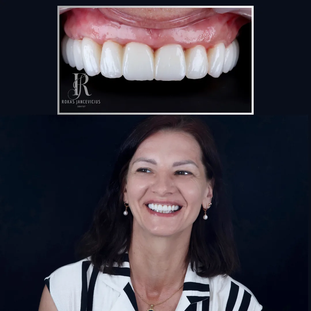 Complex Smile Implant Centre photo 6