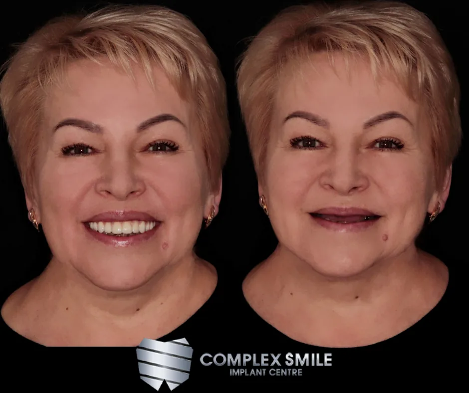 Complex Smile Implant Centre photo 2