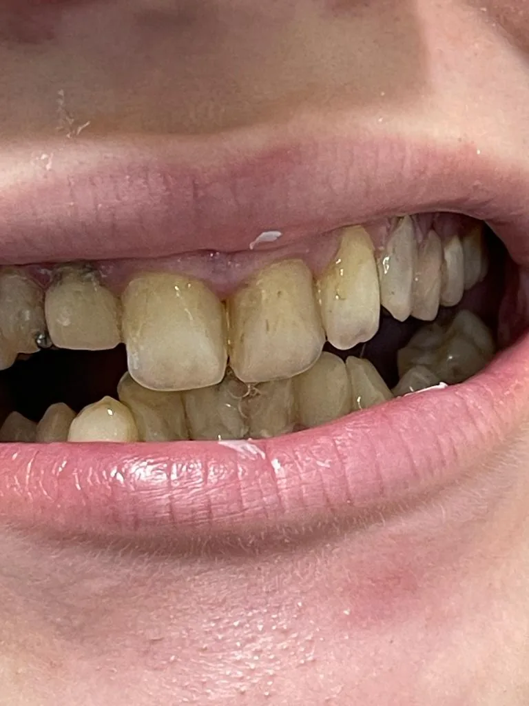 ACE dental photo 4
