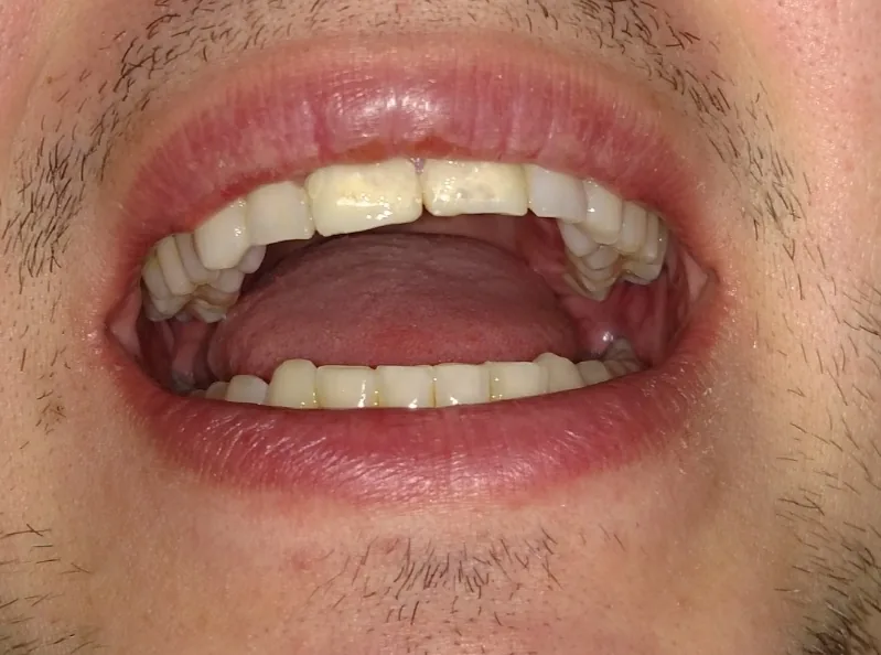 Smile Center Buffalo, NY photo 4