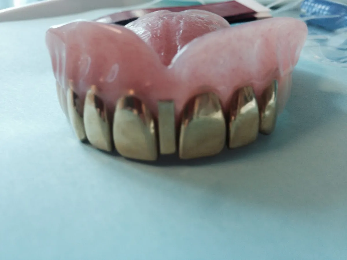 Canarsie Family Dentistry photo 5