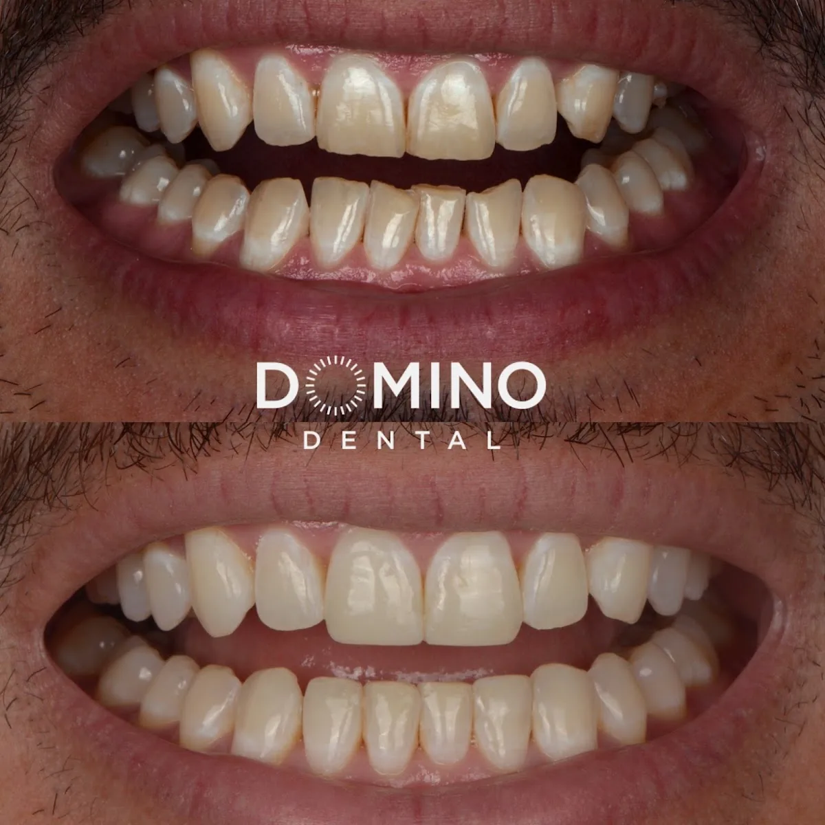 Domino Dental - Dr. Lilya Horowitz, DDS, AAACD, FAGD photo 2