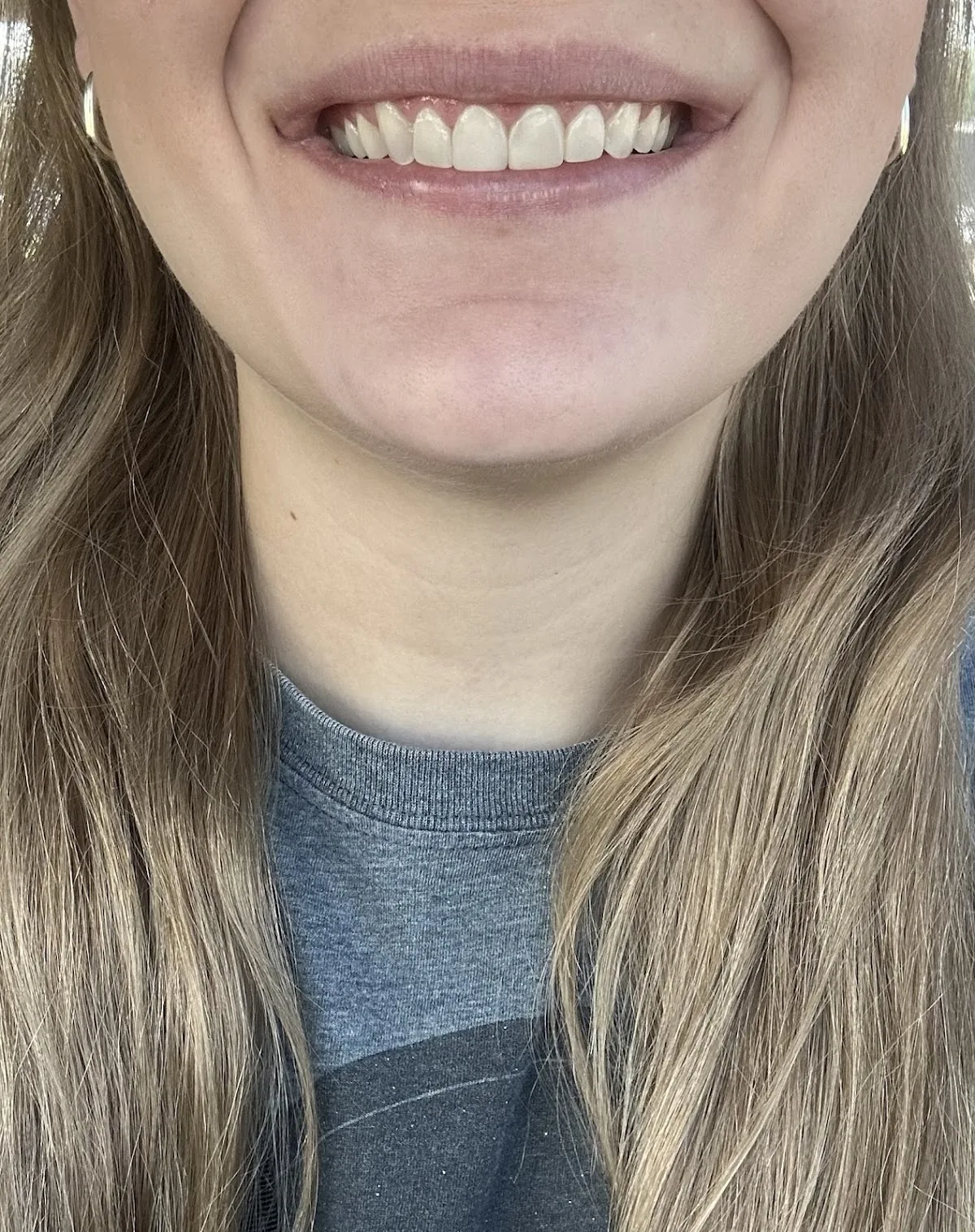 Cook Family and Cosmetic Dentistry: Aaron Cook, DMD photo 5