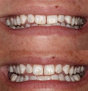 Central Avenue Dentistry photo 2
