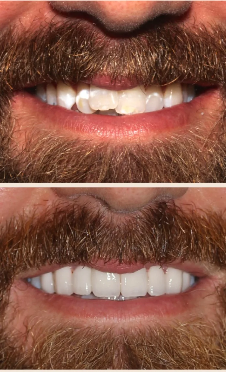 StoneCreek Dental Care - Birmingham Montclair photo 1
