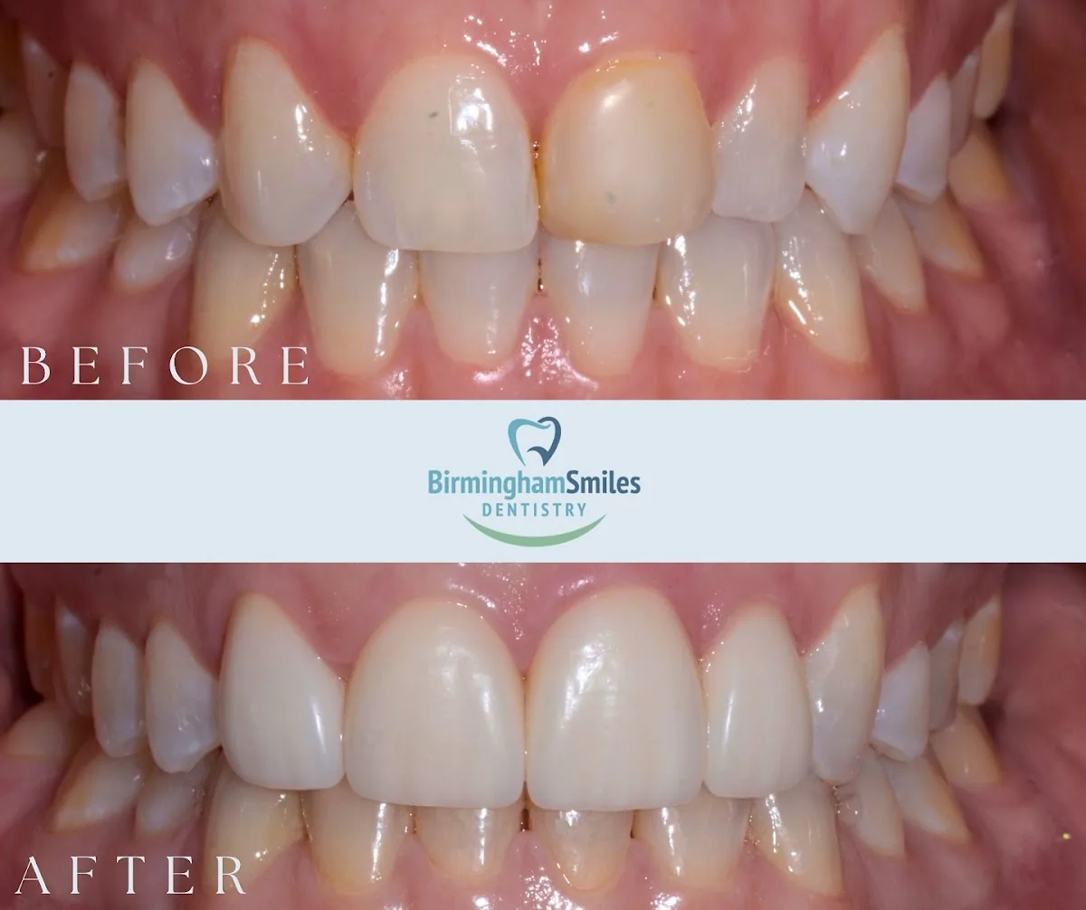 Birmingham Smiles Dentistry photo 5