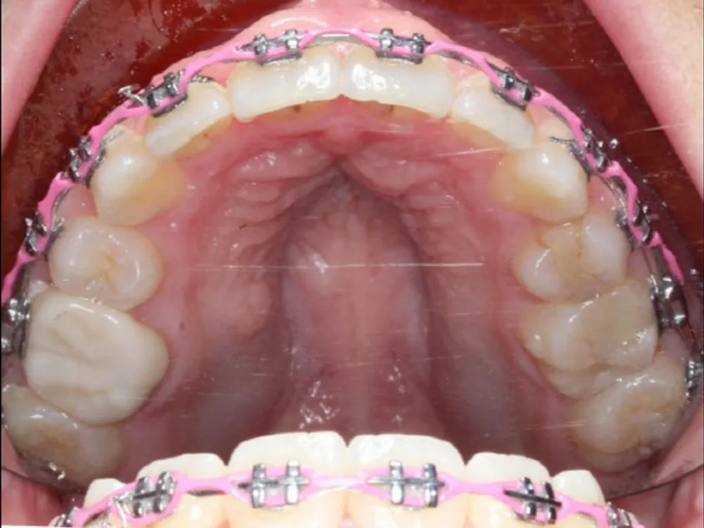 Normandy Lake Dentistry photo 2