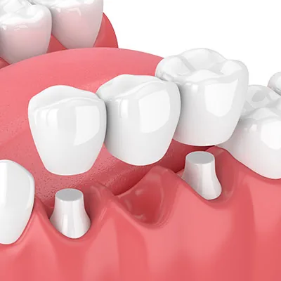 Dentistry of Oxnard photo 2
