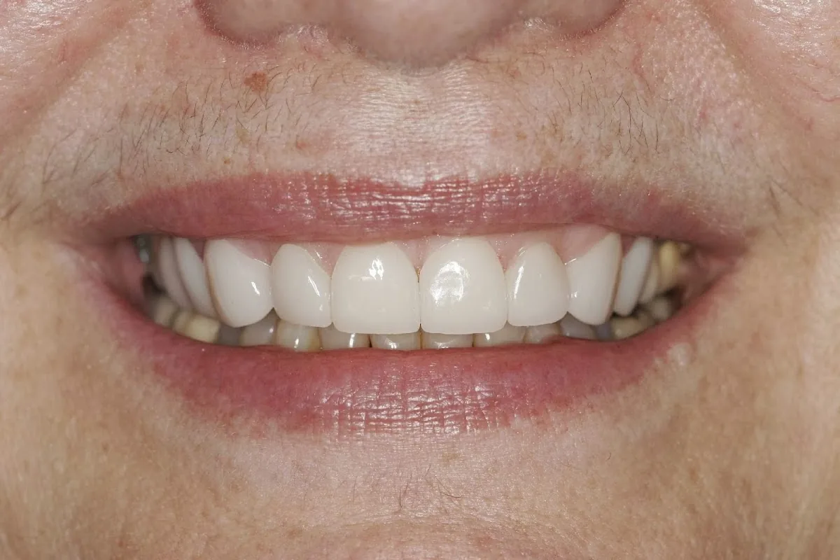 AZ Dentist - Modern Family Dentistry photo 5