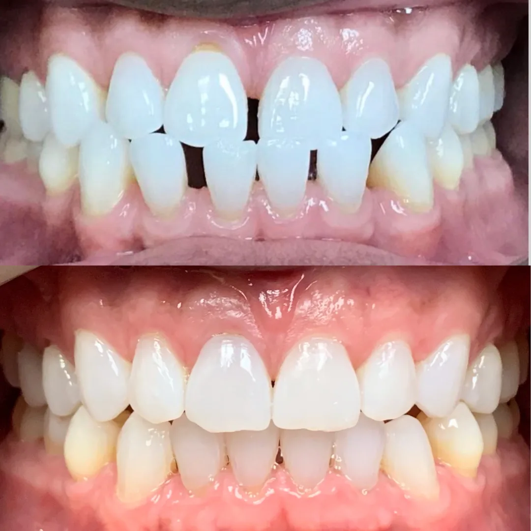 Italian Smiles Family and Cosmetic Dentistry