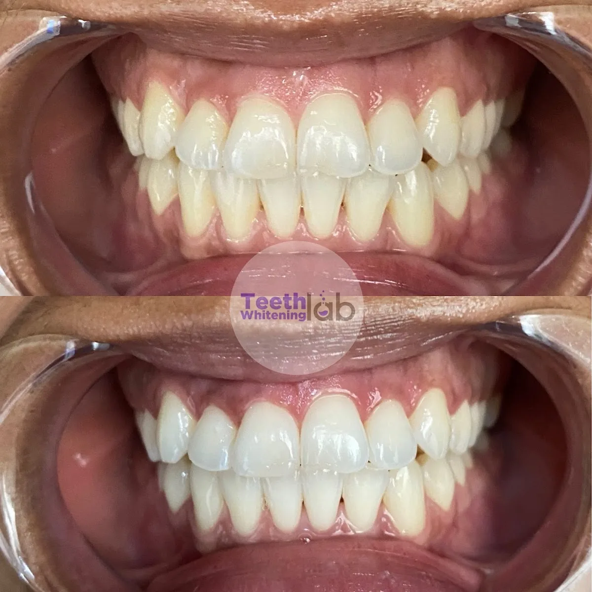 Teeth Whitening Lab Long Beach photo 2