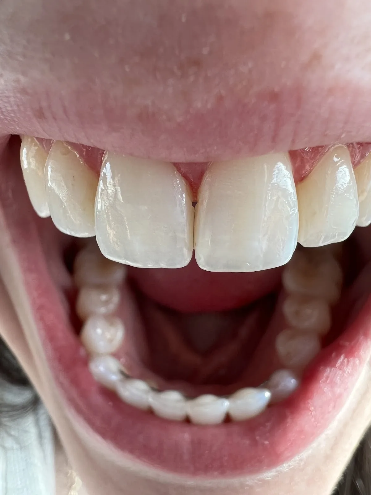 Williamsville Family Dentistry photo 4