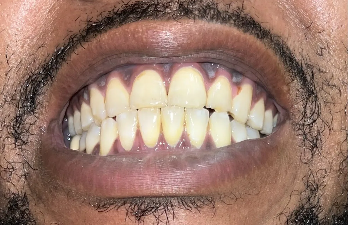 Teeth Whitening Spa 2 photo 5