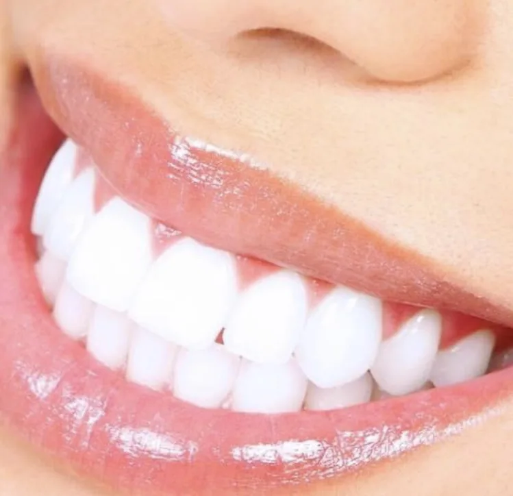 Teeth Whitening Spa 2 photo 1