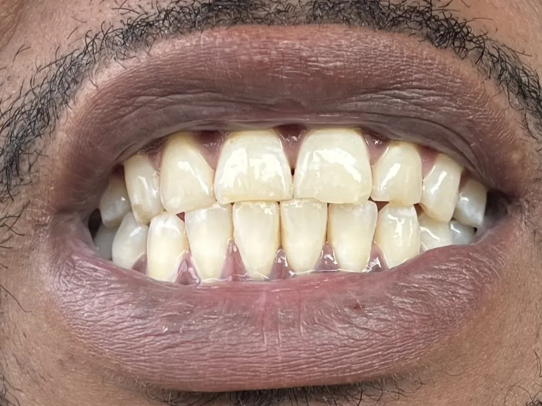 Teeth Whitening Spa 2 photo 2
