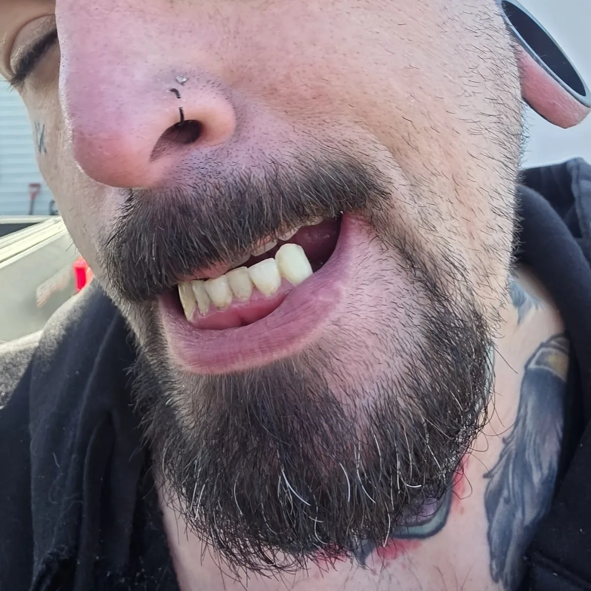 Better Smile photo 1