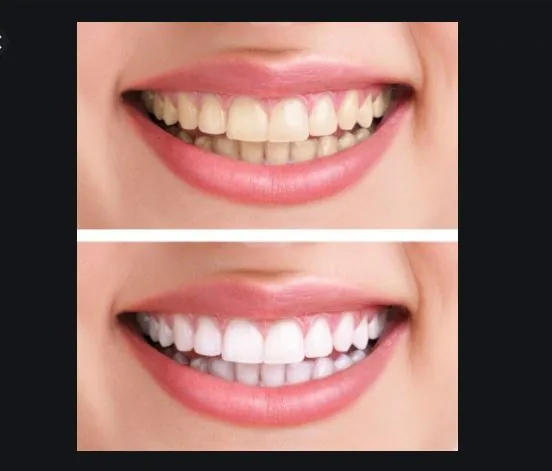 Cosmetic Dentistry Capalaba | Capalaba Dental Surgery photo 2