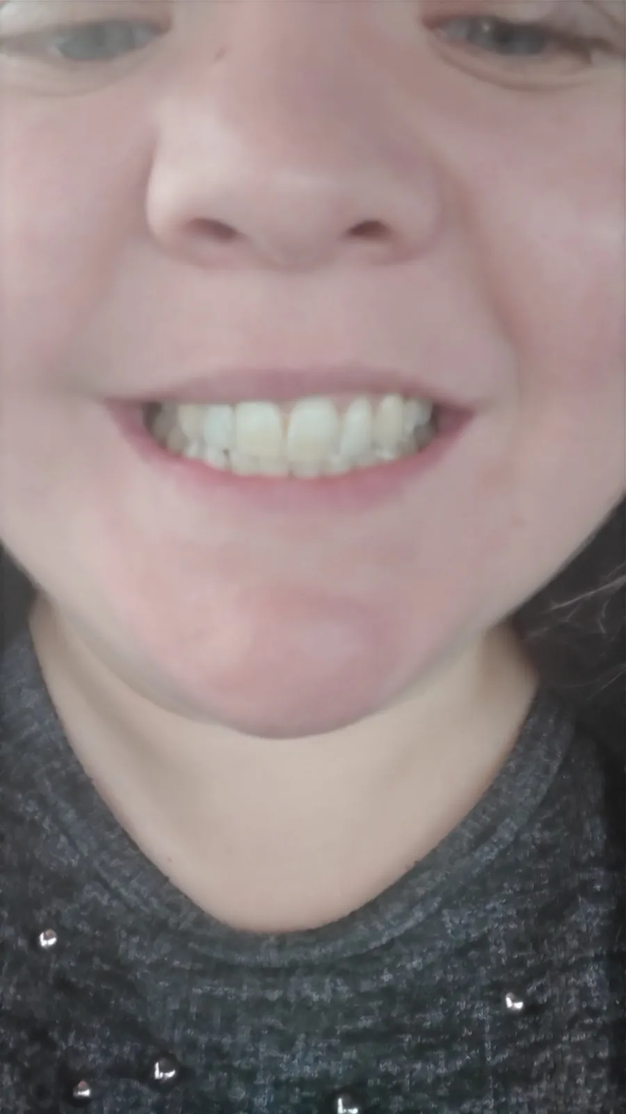 Hunts Cross Dental Centre photo 4