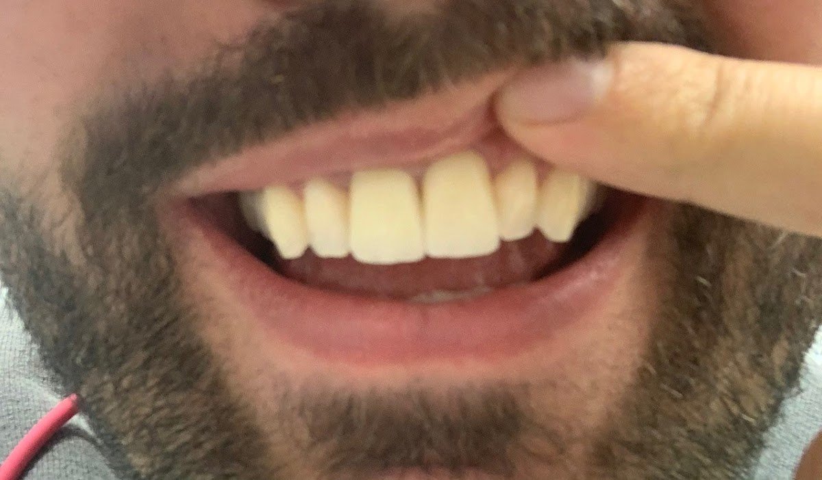 Alpha Dental Somerville photo 3