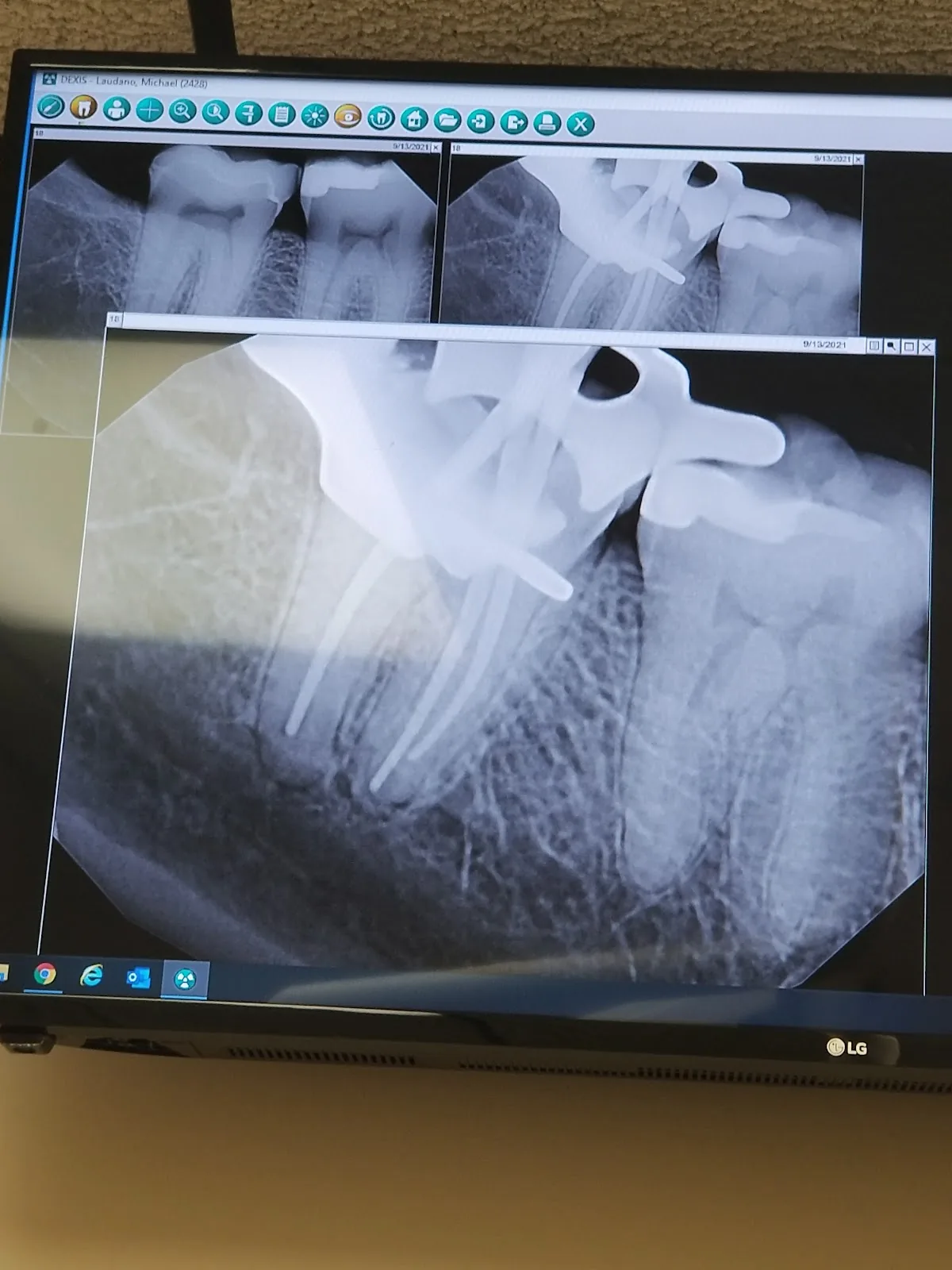 Drs. Delgado & Kamaris, Endodontics photo 2