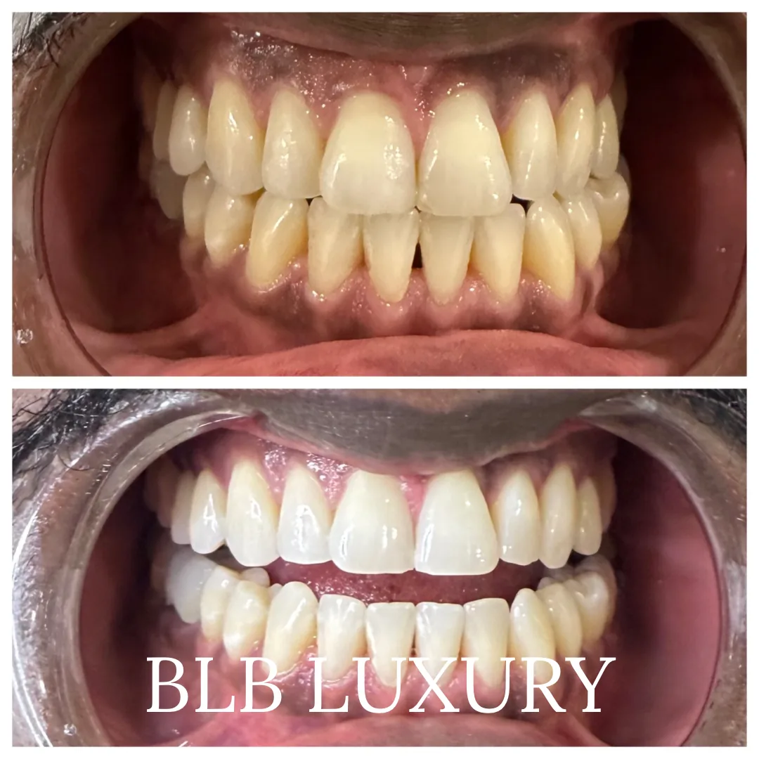 BLB LUXURY photo 3