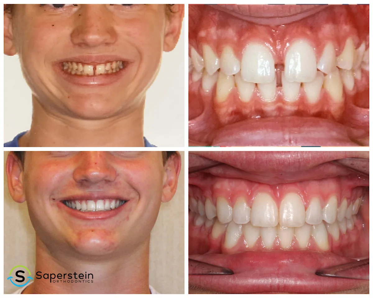 Saperstein Orthodontics photo 2