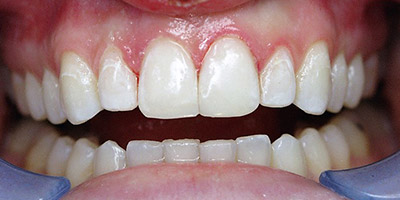 Dental Arts of Boston | Dr. George Stevens and Associates photo 1