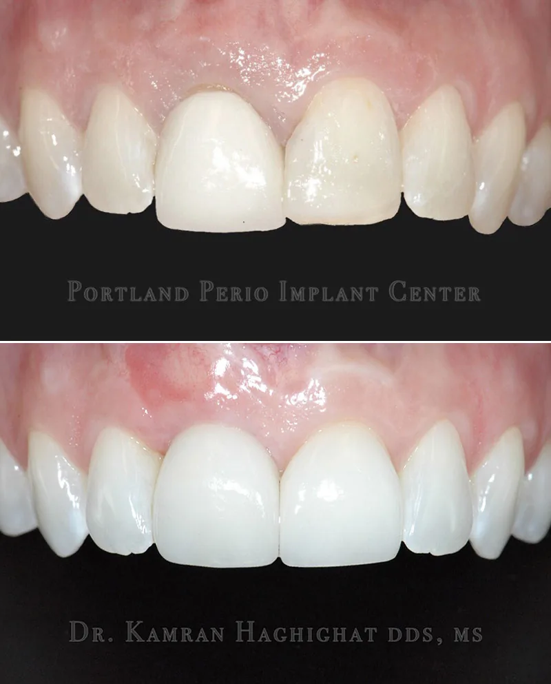 Portland Perio Implant Center