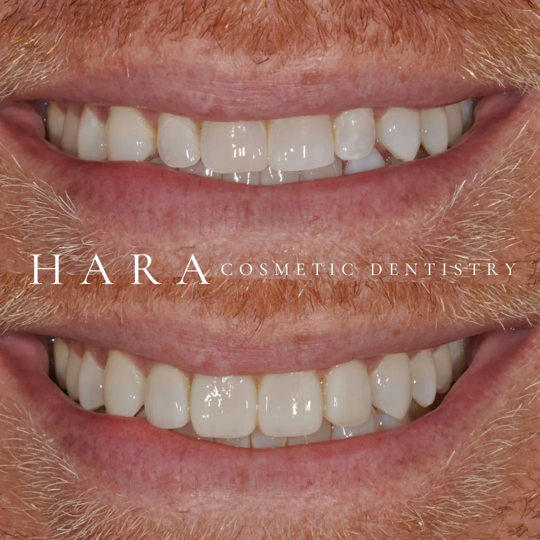 HARA Cosmetic Dentistry photo 2