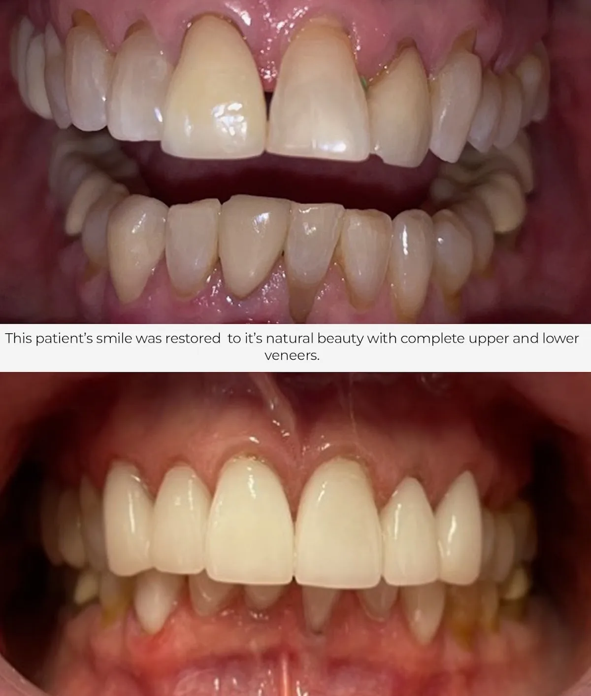 Eastport Dental AZ - Mesa photo 2